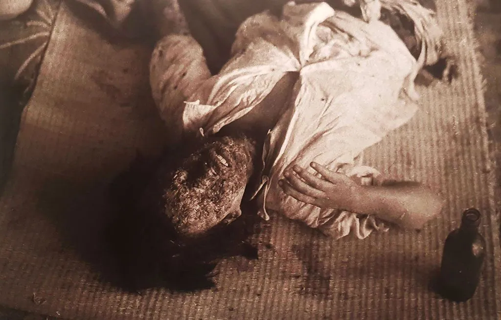 Hiroshima museum photograph of burns